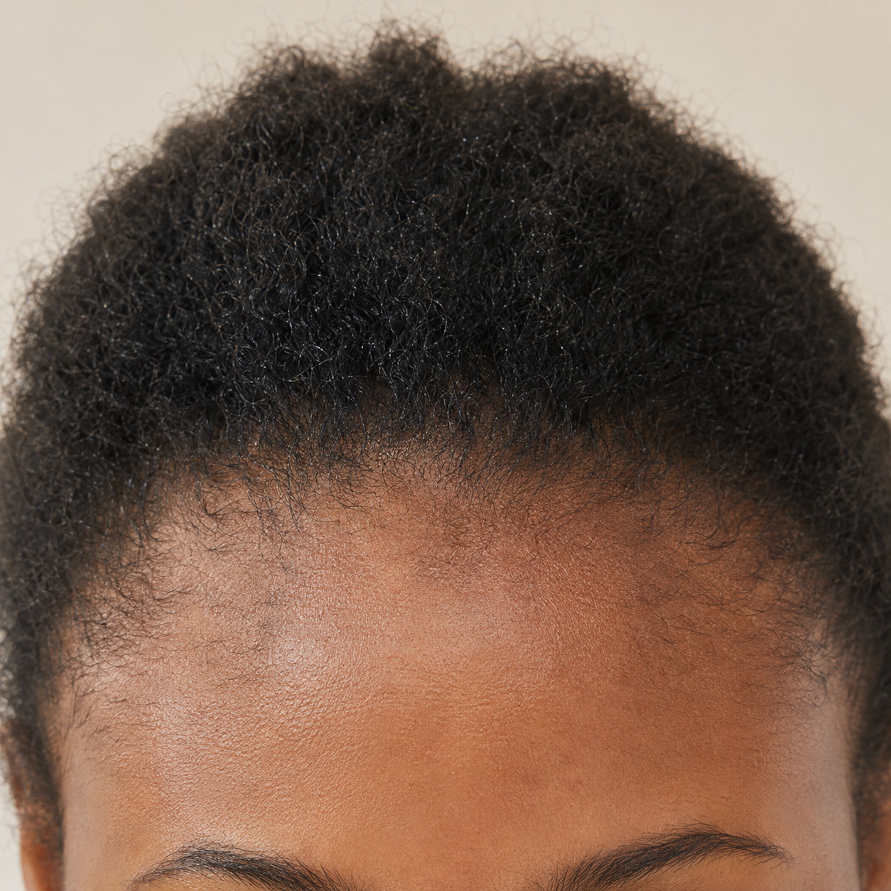 Hair before consistent care
